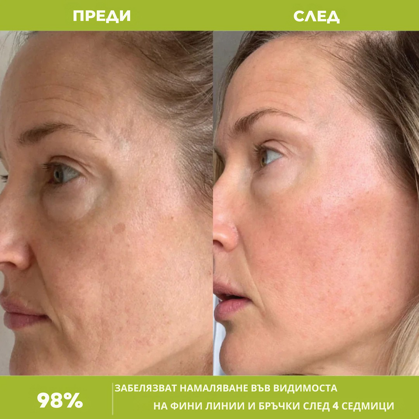 Renova™ Ретиналов Крем